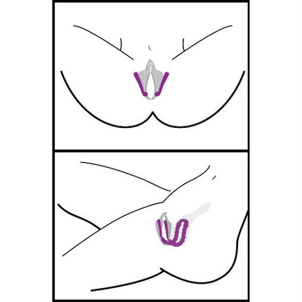 Oral Enhancing Hands Free Labia Spreader - BDSM Toys