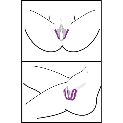 Oral Enhancing Hands Free Labia Spreader - BDSM Toys